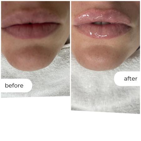 ХИДРА ГЛОС ЛИПС