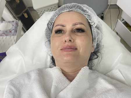 ЗЛАТЕН ТРЕТМАН СО КАВИЈАР